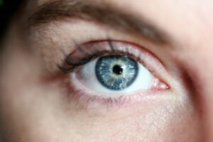 This is an image of an eye. Purpose of image is to show that Bartonella infection can cause ophthalmic complications.